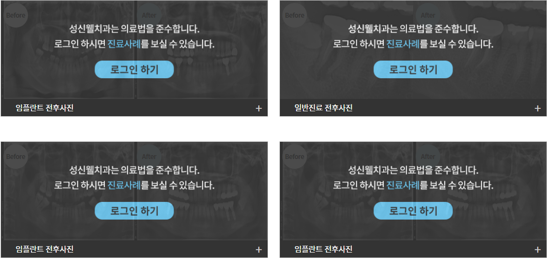 성신웰치과의 치료 사례